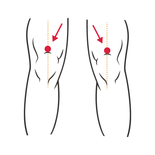 走路運動健康：膝蓋正中央，上方一個凹陷處，左右各貼上1顆舒利貼